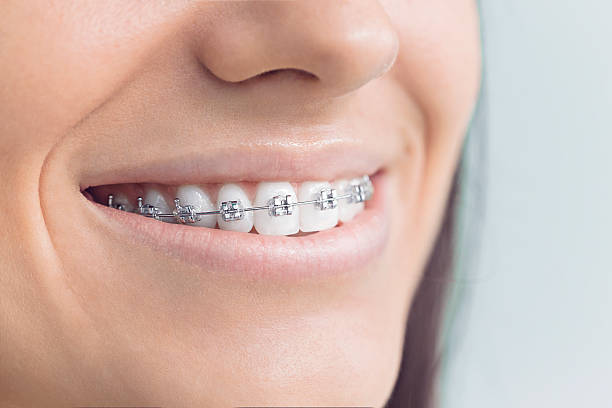 Best Invisalign and Clear Aligners  in Myerstown, PA